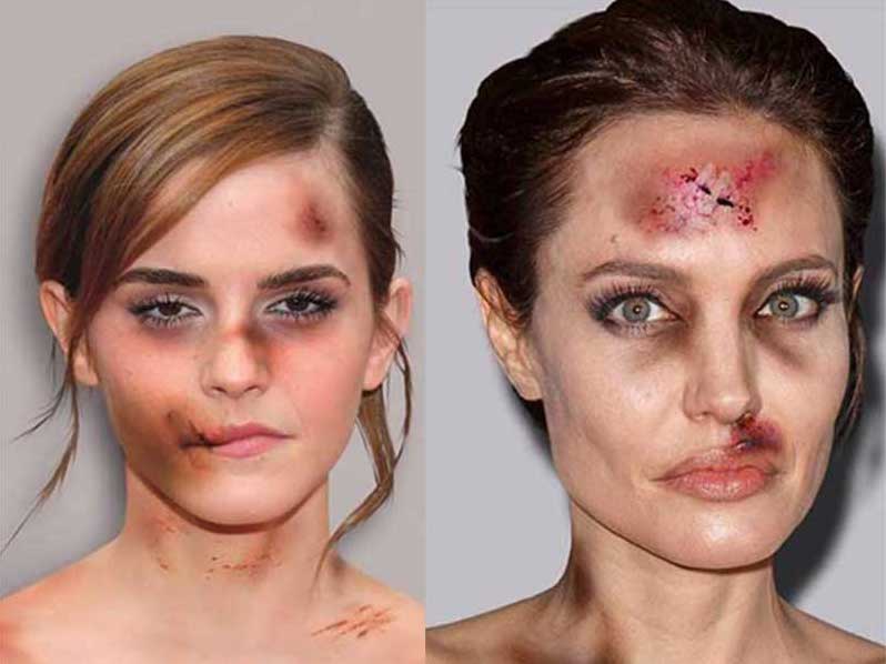 Emma Watson y Angelina Jolie en los carteles de aleXandro Palombo